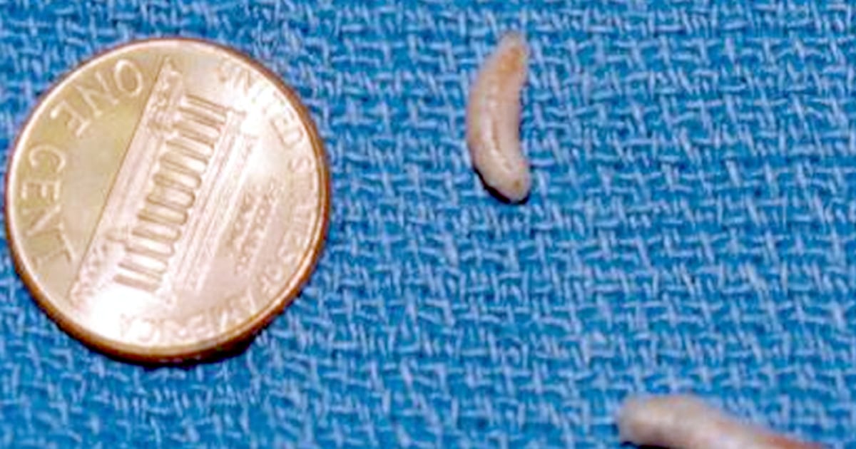 Detail Images Of Maggots Nomer 54