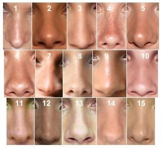 Detail Images Of Noses Nomer 14