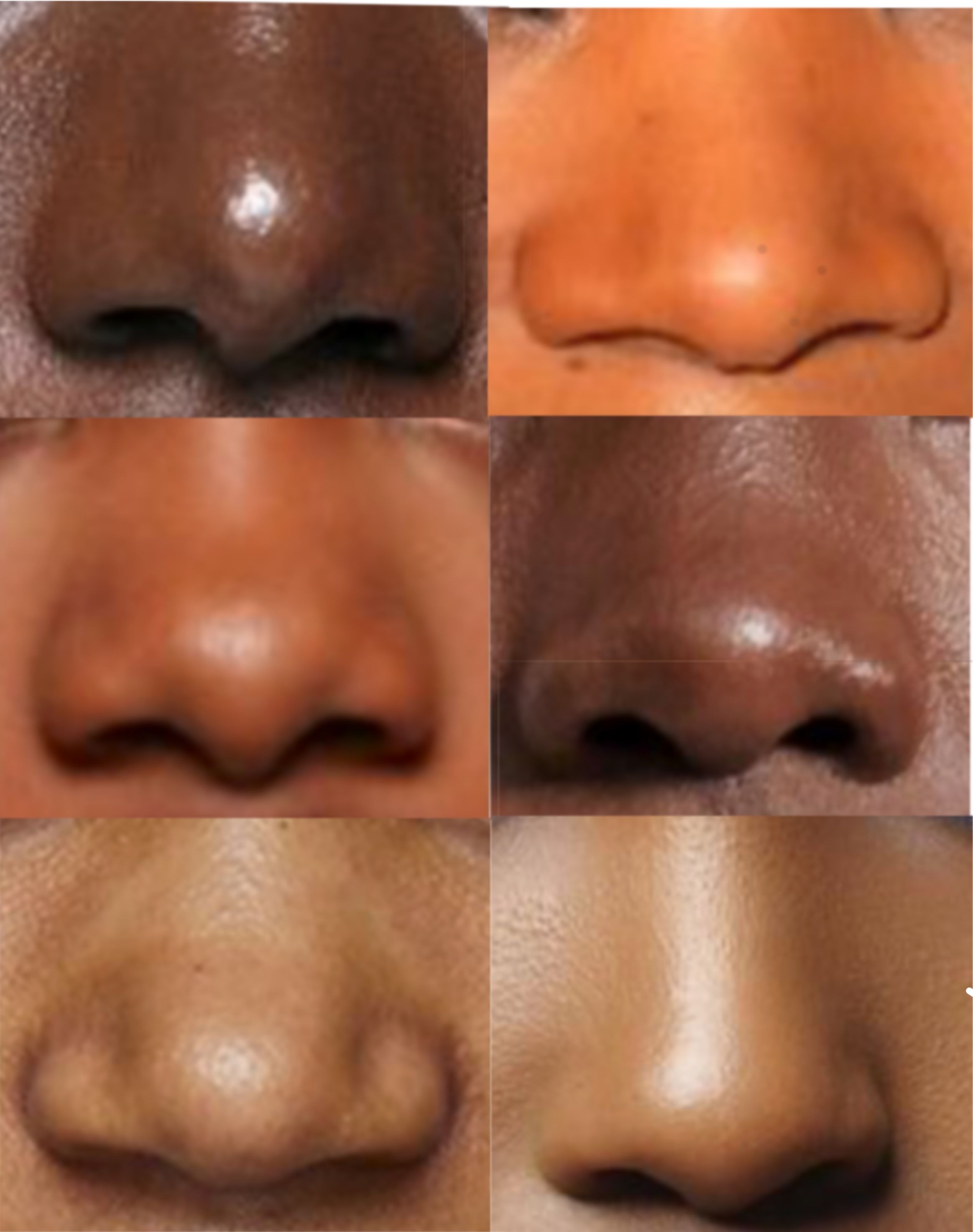 Detail Images Of Noses Nomer 5