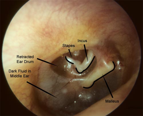 Detail Images Of The Ear Nomer 39