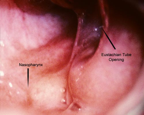 Detail Images Of The Ear Nomer 46