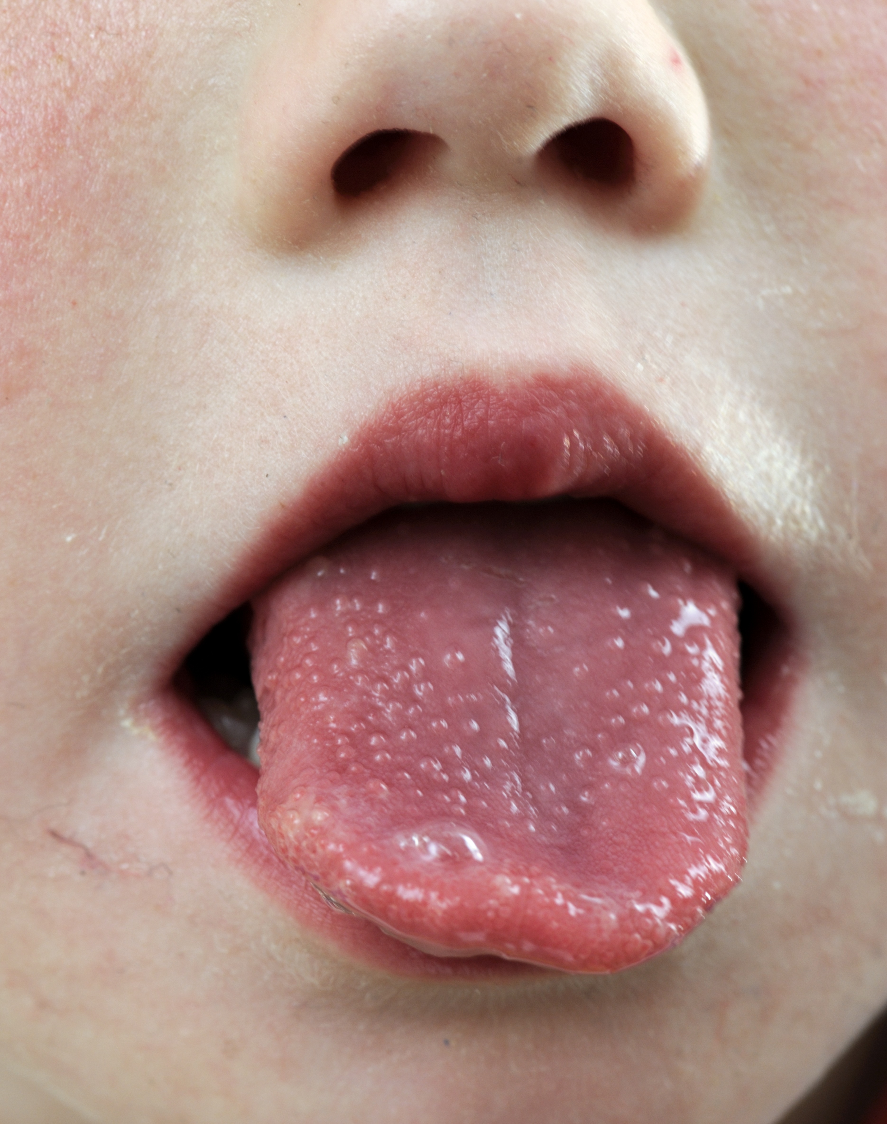 Detail Images Of Tongue Nomer 41