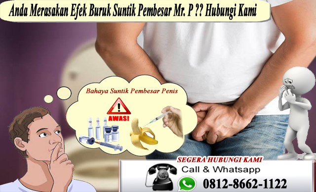 Detail Jangka Pembesar Gambar Nomer 39