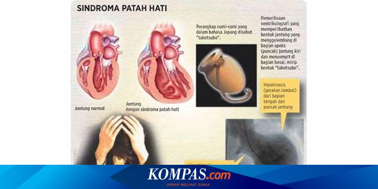 Detail Jantung Dan Hati Nomer 52