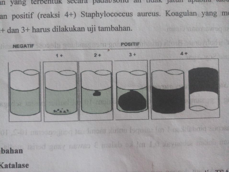 Detail Journal Gambar Uji Biokimia Staphylococcus Aureus Pada Lalat Nomer 17