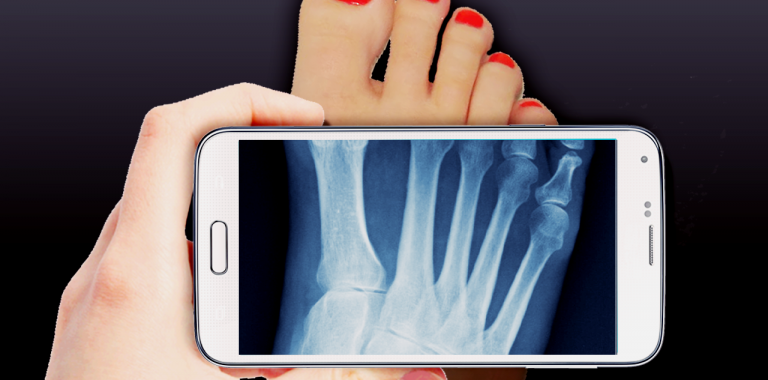 Detail Kamera X Ray Android Nomer 34