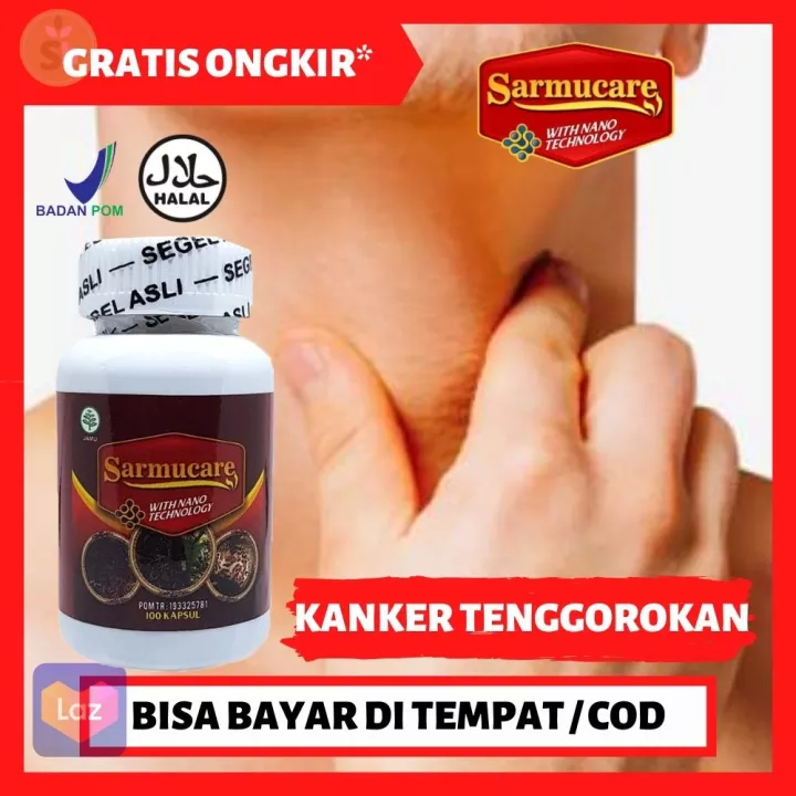 Detail Kanker Tonsil Gambar Nomer 48