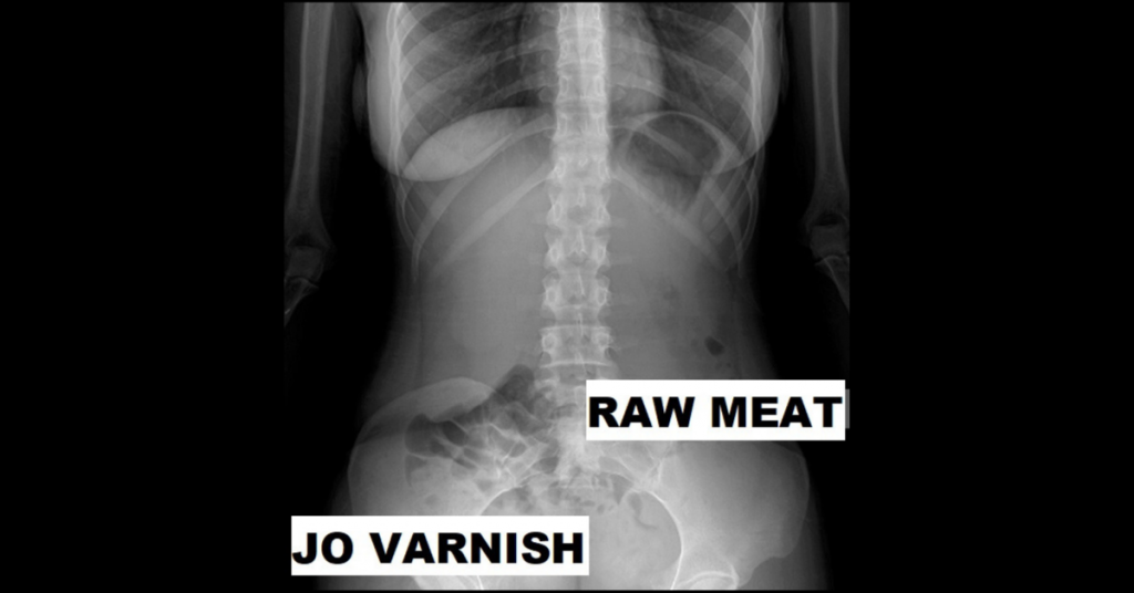 Detail Ariel Winter Xray Nomer 34