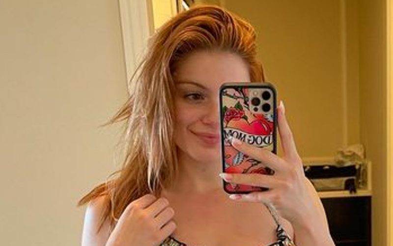 Detail Ariel Winter Xray Nomer 36