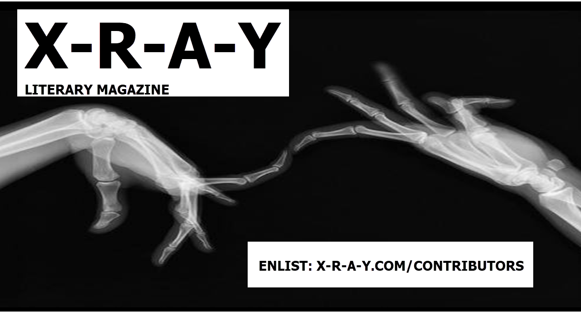 Detail Ariel Winter Xray Nomer 50