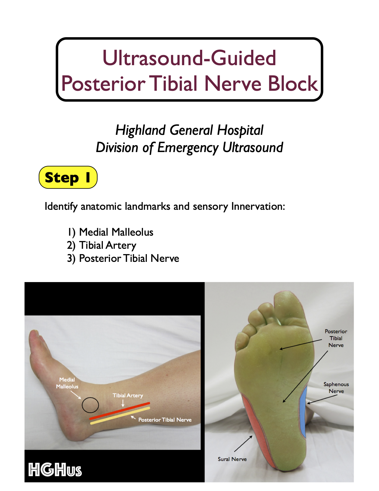 Detail Arteri Tibialis Posterior Nomer 39