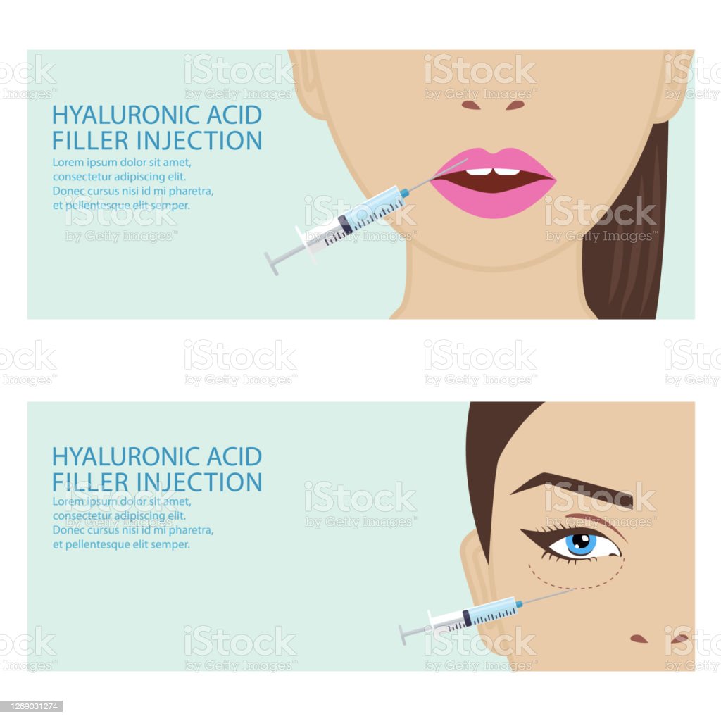 Detail Asam Hyaluronic Injeksi Nomer 27