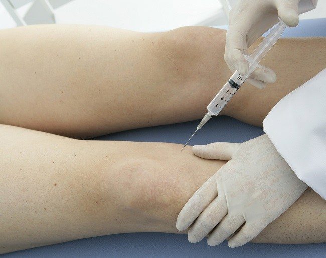 Detail Asam Hyaluronic Injeksi Nomer 6