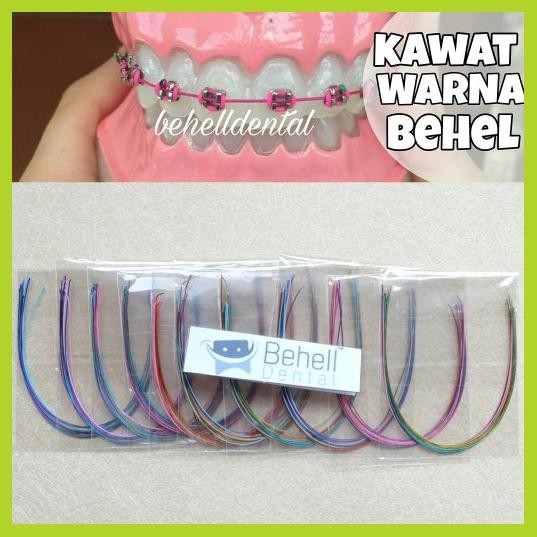 Detail Kawat Gigi Warna Warni Nomer 24