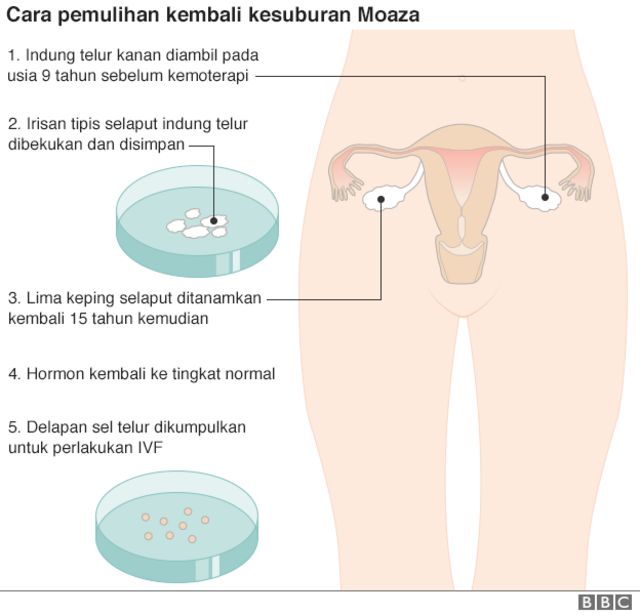 Detail Gambar Sel Telur Nomer 29