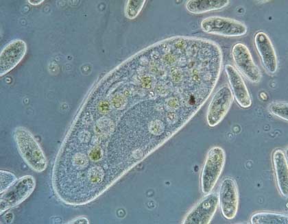 Detail Contoh Gambar Protozoa Nomer 45