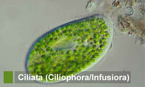 Detail Contoh Gambar Protozoa Nomer 48