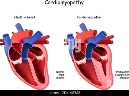 Detail Gambar Kardiovaskuler Normal Anatomi Af The Heart Nomer 12