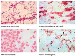Detail Bakteri Neisseria Meningitidis Nomer 40