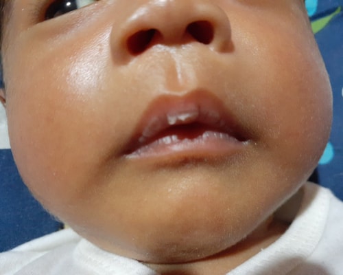 Detail Pelembab Bibir Bayi Nomer 16