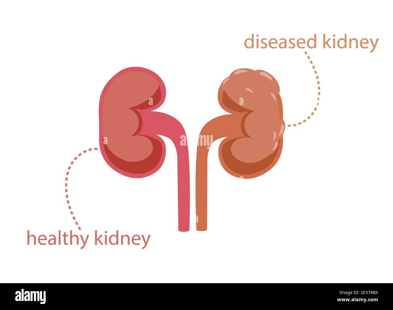 Detail Kidney Clipart Nomer 31