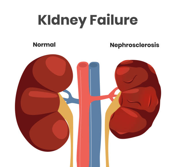 Detail Kidney Clipart Nomer 6