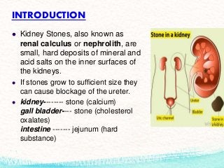Kidney Stone Ppt - KibrisPDR