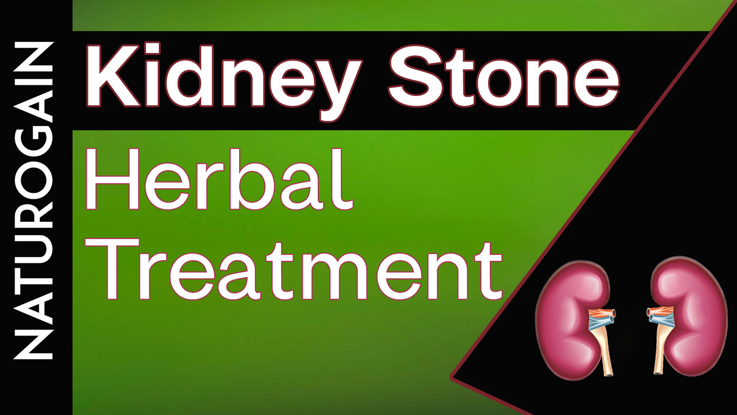 Detail Kidney Stone Ppt Nomer 10