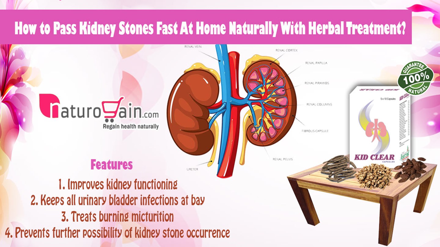 Detail Kidney Stone Ppt Nomer 11
