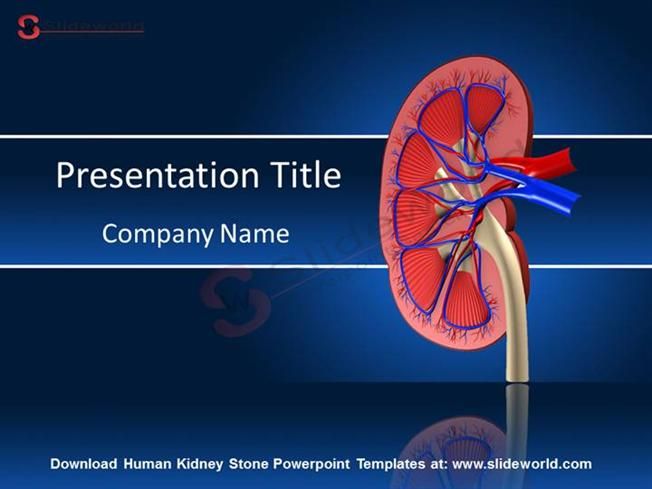 Detail Kidney Stone Ppt Nomer 12