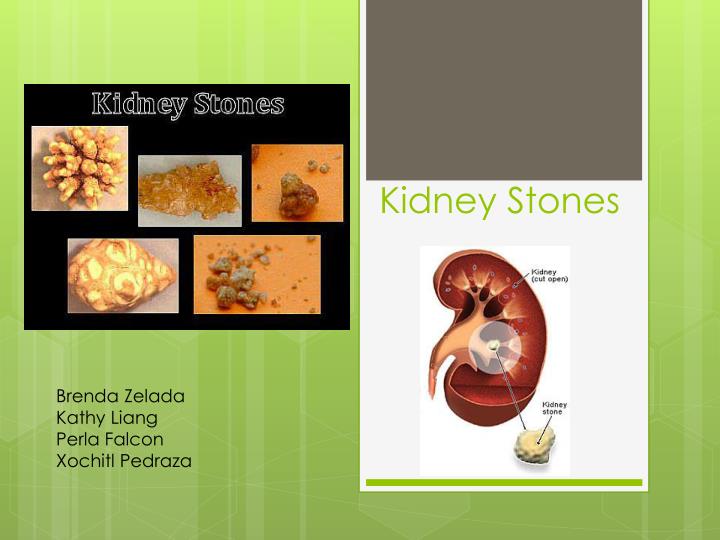 Detail Kidney Stone Ppt Nomer 13