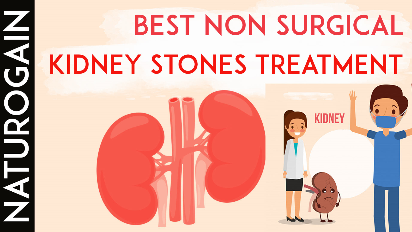 Detail Kidney Stone Ppt Nomer 19