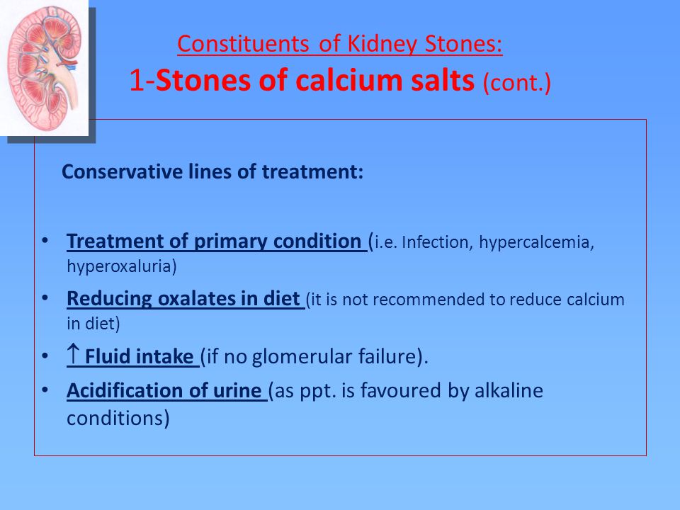 Detail Kidney Stone Ppt Nomer 20