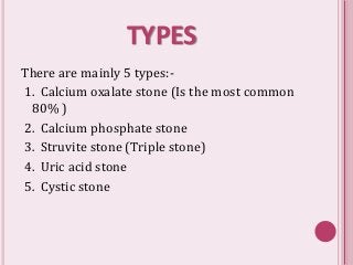 Detail Kidney Stone Ppt Nomer 21