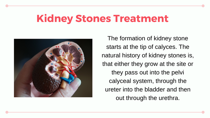 Detail Kidney Stone Ppt Nomer 4