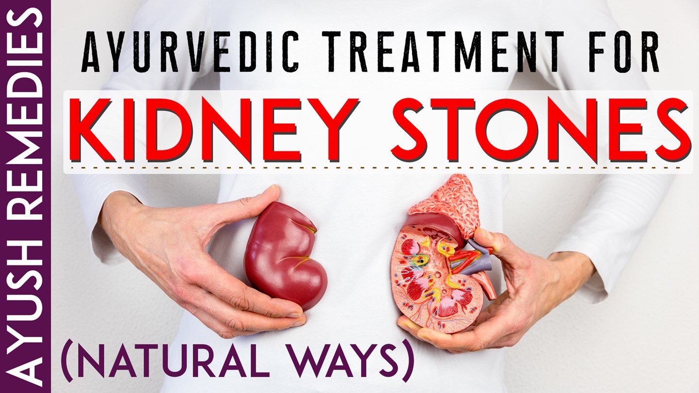 Detail Kidney Stone Ppt Nomer 29