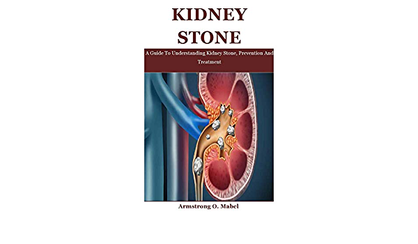 Detail Kidney Stone Ppt Nomer 45