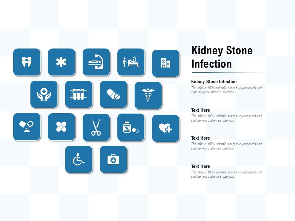 Detail Kidney Stone Ppt Nomer 46