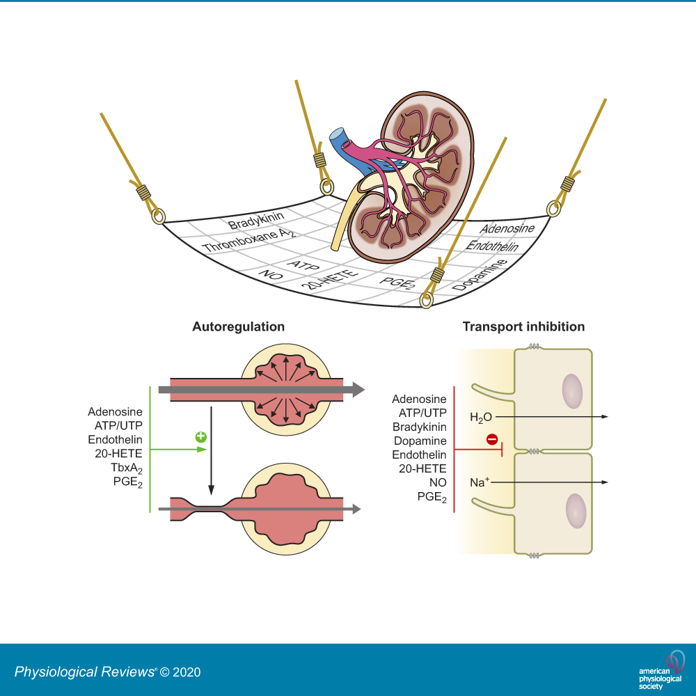Detail Kidney Stone Ppt Nomer 54