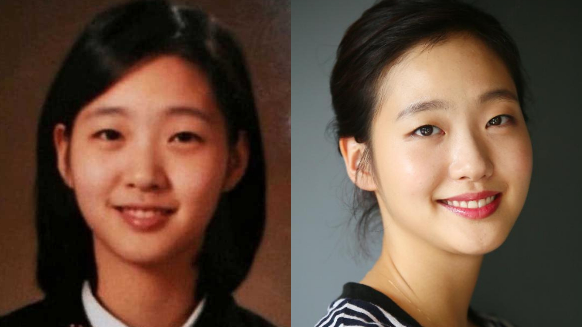 Kim Go Eun Plastic Surgery - KibrisPDR