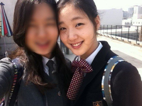 Detail Kim Go Eun Plastic Surgery Nomer 11