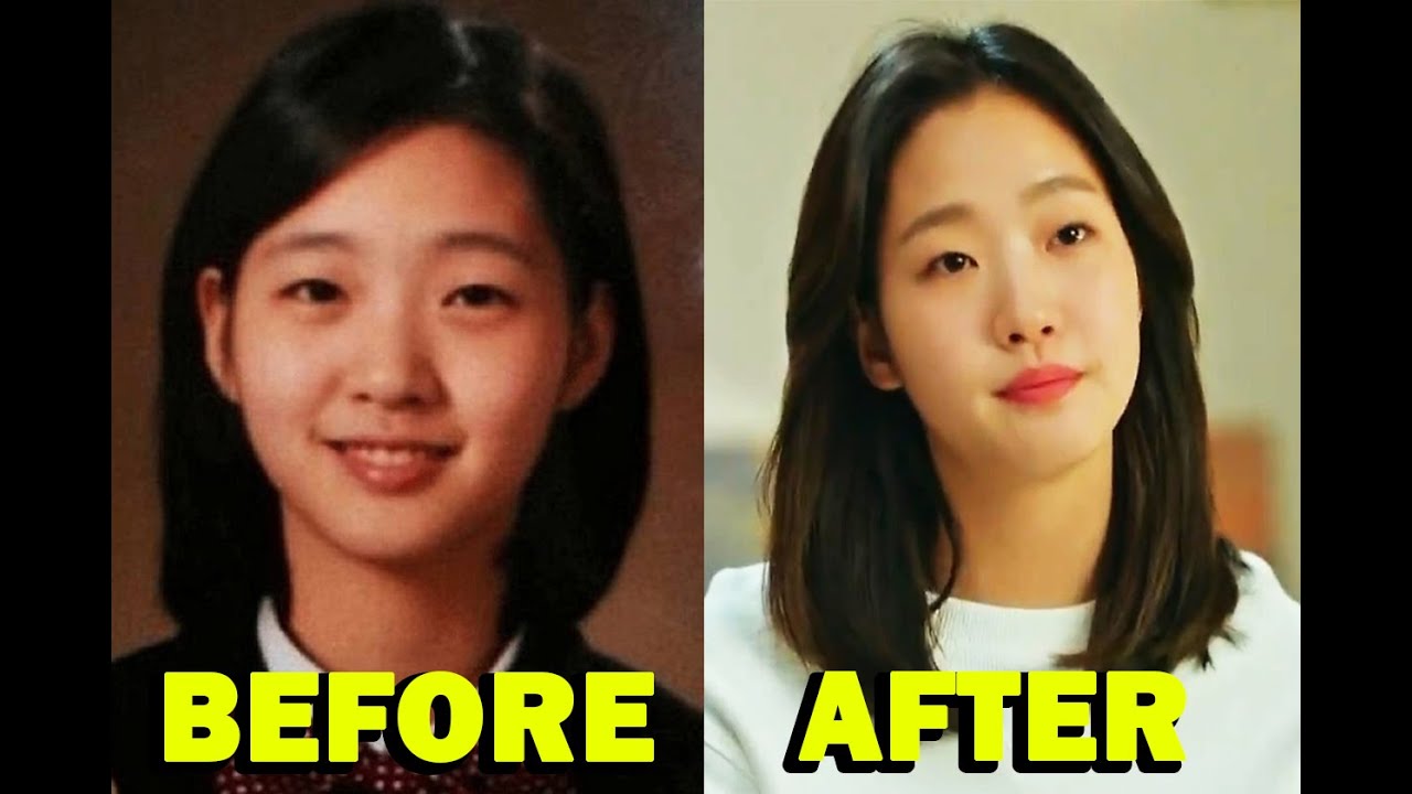 Detail Kim Go Eun Plastic Surgery Nomer 16