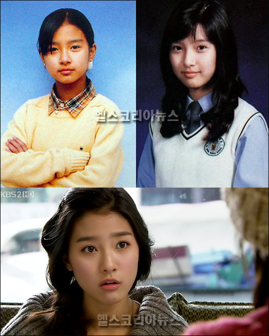 Detail Kim Go Eun Plastic Surgery Nomer 21