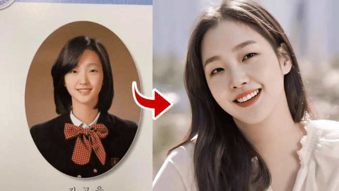 Detail Kim Go Eun Plastic Surgery Nomer 6