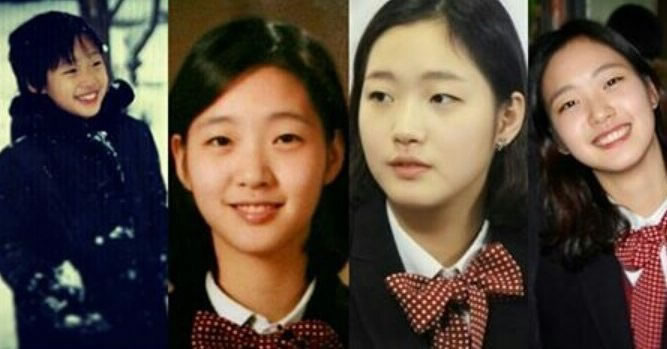 Detail Kim Go Eun Plastic Surgery Nomer 8
