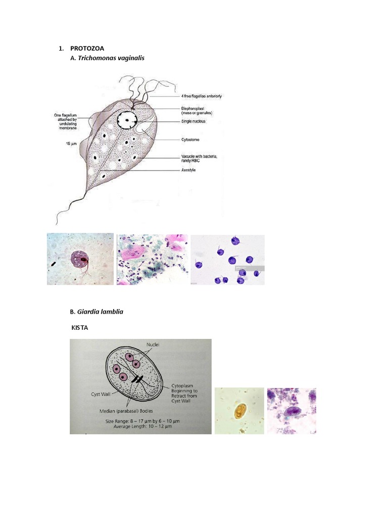 Detail Kista Giardia Lamblia Nomer 36