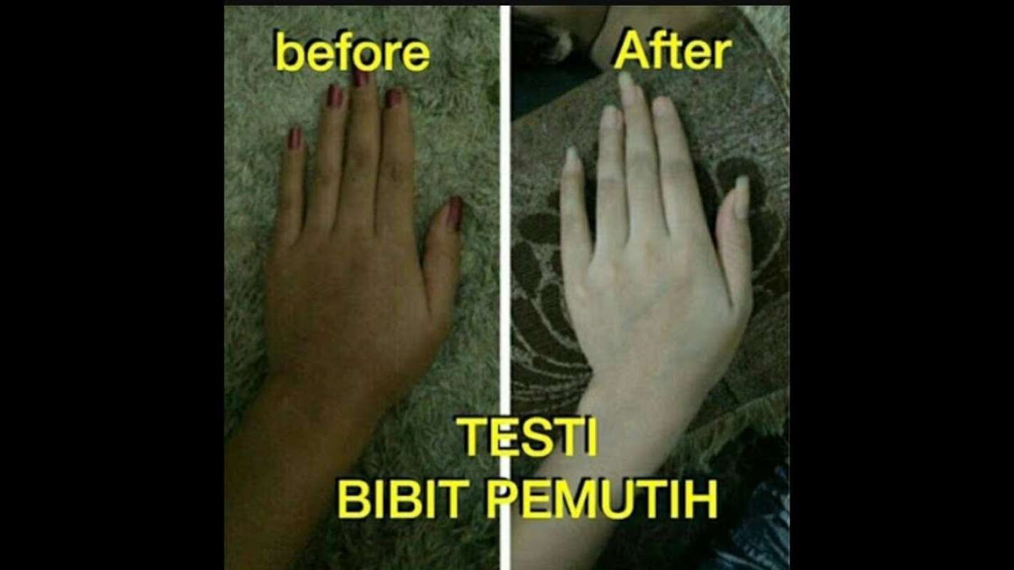 Detail Krim Pemutih Kulit Tangan Nomer 35