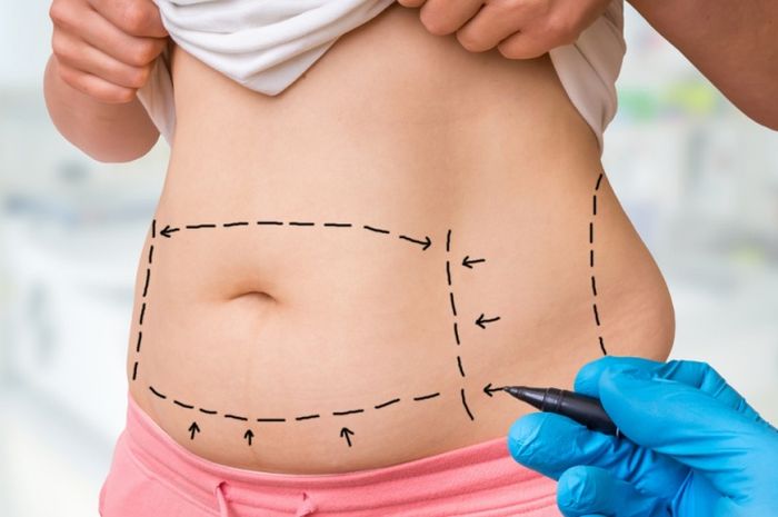 Detail Kriteria Gambar Abdomen Later Nomer 28