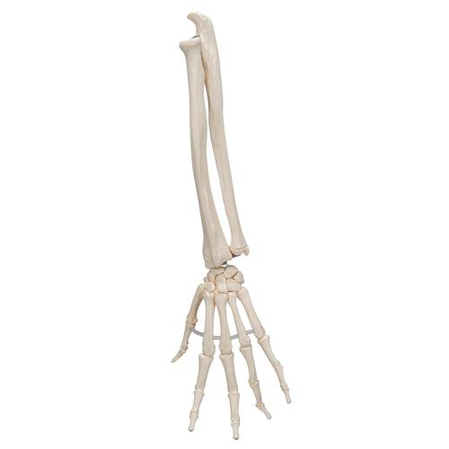 Detail Knochen Im Arm Nomer 6