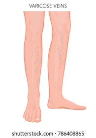 Detail Leg Images Nomer 4